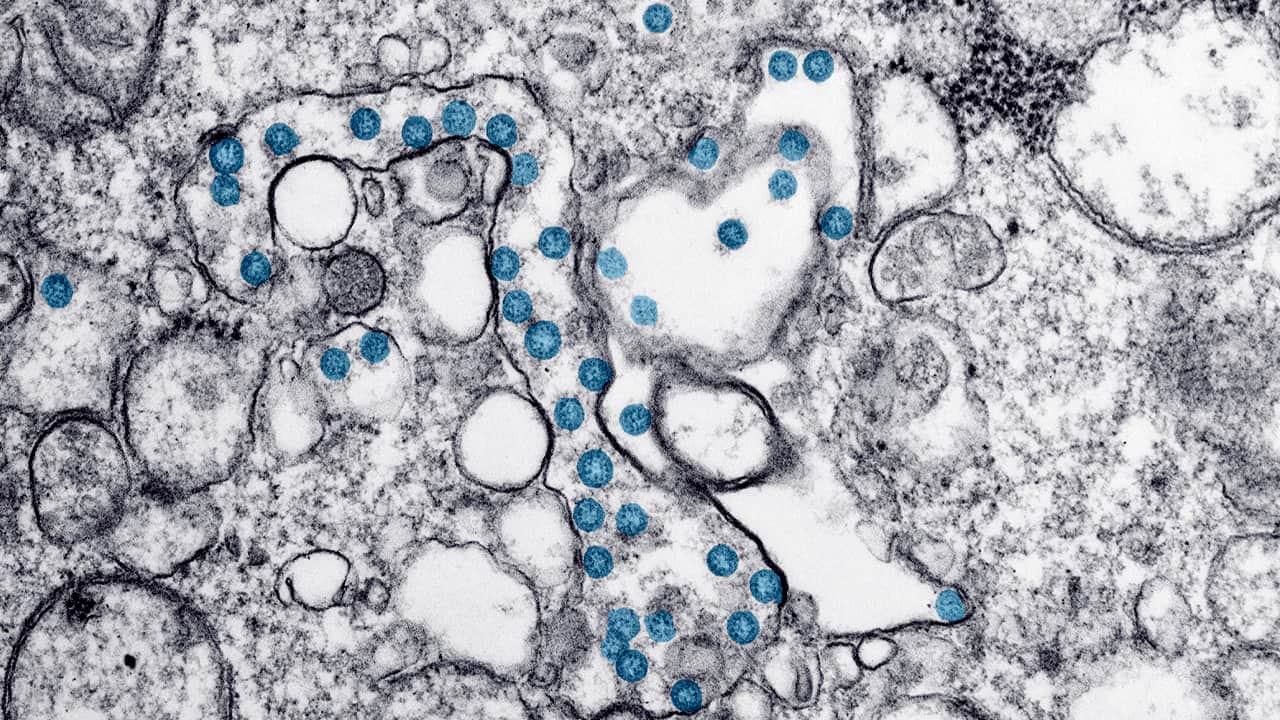 Photo of the new coronavirus