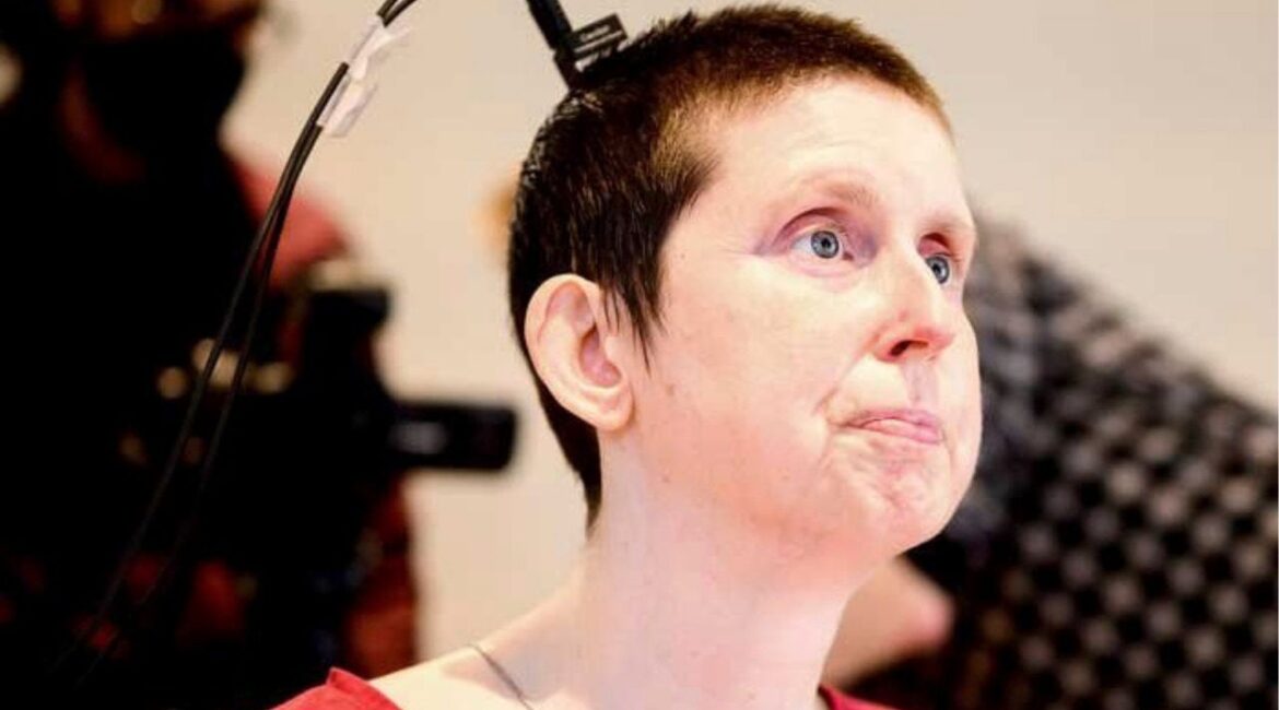 This photo provided by researchers at UCSF and UC Berkeley shows Ann, a participant in a study on speech neuroprostheses, in California in 2023. (Noah Berger/UCSF, UC Berkeley via AP)