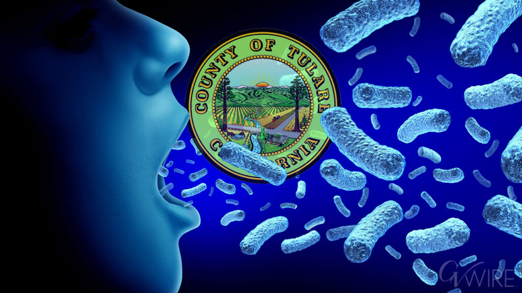 Tulare County experiencing an increase of whooping cough cases